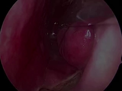 डिस्पोजेबल अल्ट्रा-छोटा और लचीला न्यूरोलॉजी प्रोब PLA407